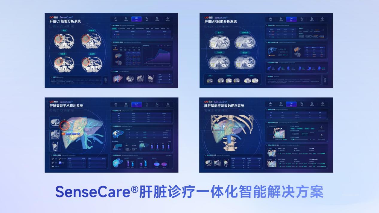 商汤医疗获得肝脏CT辅助诊断产品首张NMPA三类证，赋能肝脏诊疗一体化